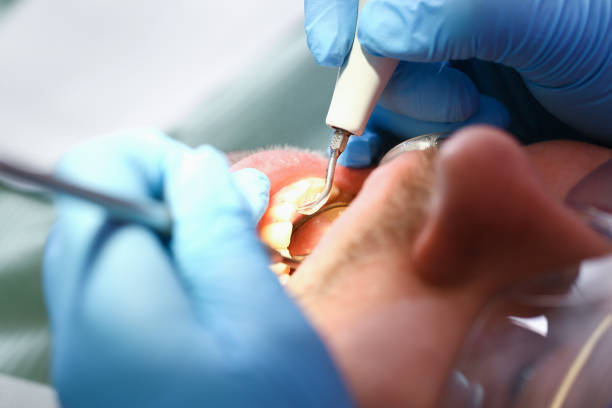 Best Dentist for Severe Toothache  in Grantsburg, WI