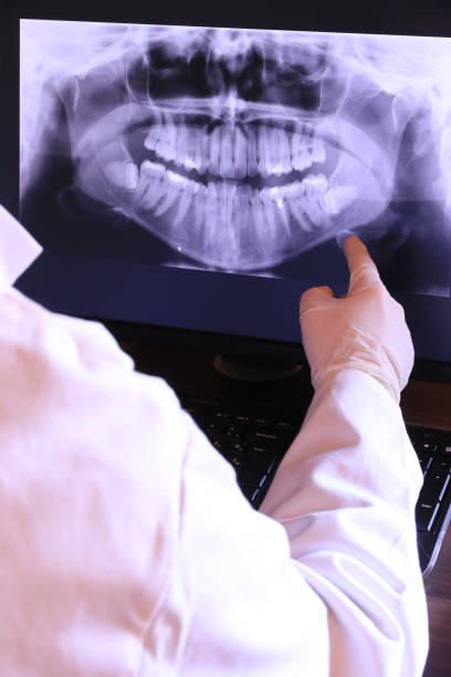 Best Dentist for Tooth Abscess  in Grantsburg, WI